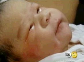 Em bé Mỹ đầu tiên ra đời từ tinh trùng và trứng đông lạnh
