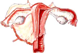 Bước đột phá mới trong điều trị ung thư buồng trứng