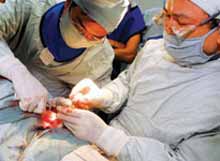 ICD thiết bị cứu sống hàng triệu người bệnh tim