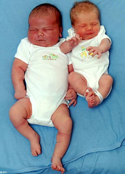 Bé sơ sinh nặng gần 7 kg
