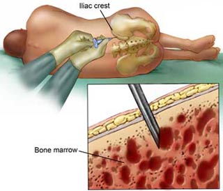 Hội chứng thực bào tế bào máu