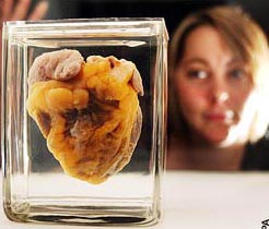Xem trưng bày trái tim của chính mình