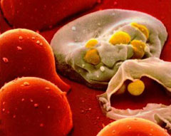 Đột phá mới chữa trị AIDS
