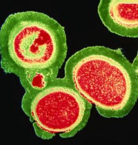 MRSA nguy hiểm hơn HIV