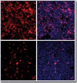 Phát hiện hàng trăm protein của con người bị virus HIV lợi dụng