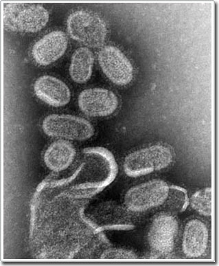 Giải thích sự lan truyền của dịch cúm năm 1918