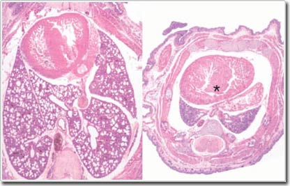 MicroRNA cường hóa giúp điều trị bệnh ung thư
