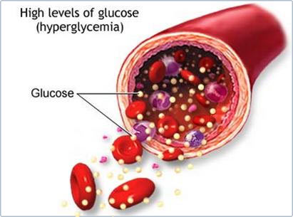 Úc: cấy ghép tế bào tạo insulin cho bệnh nhân tiểu đường type I