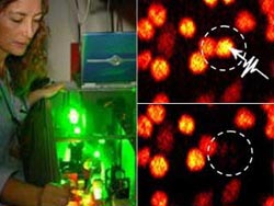 Dao laser diệt từng tế bào ung thư