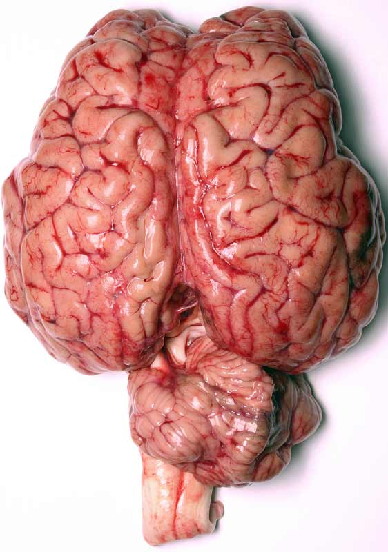 5 cách để cải thiện trí óc
