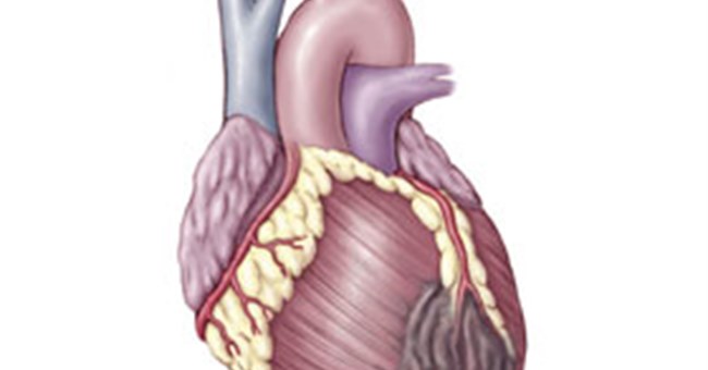 Máy đo nguy cơ bệnh tim