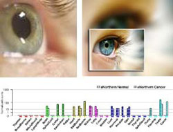 Phát hiện gene thứ 15 gây bệnh mù lòa bẩm sinh