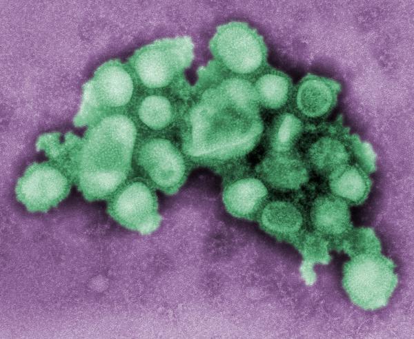 Dịch cúm A/H1N1 và mối liên hệ với sự phơi nhiễm asen ở các mức độ phổ biến 