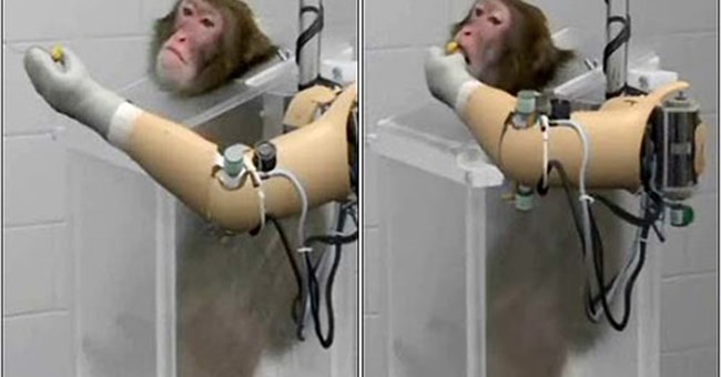 Tay nhân tạo điều khiển bằng ý nghĩ 