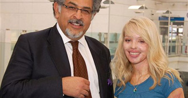 Tái tạo thành công gương mặt bị tạt axit