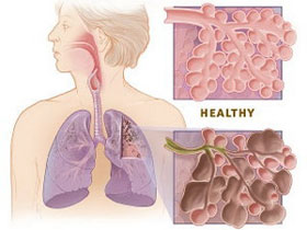 Sử dụng tế bào gốc chữa bệnh phổi tắc nghẽn