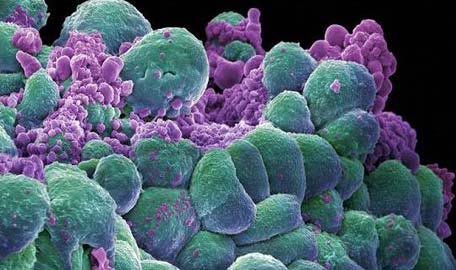 Phát hiện chủng protein có thể ngăn chặn ung thư