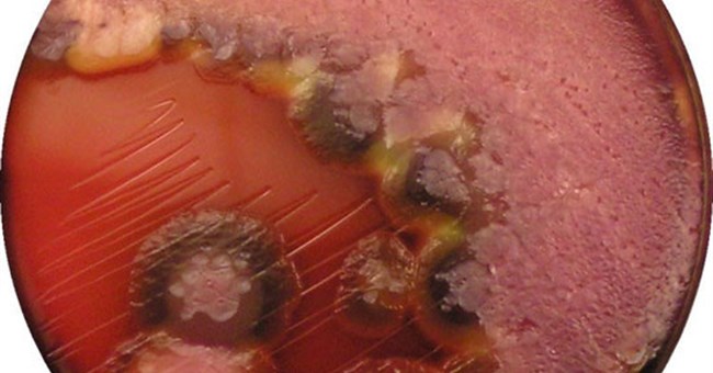 Vi khuẩn Pseudomonas aeruginosa tự di chuyển được