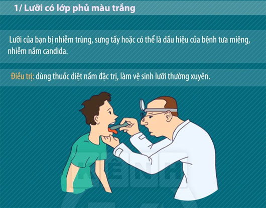 Ngó nghiêng chiếc lưỡi để đoán biết bệnh tật