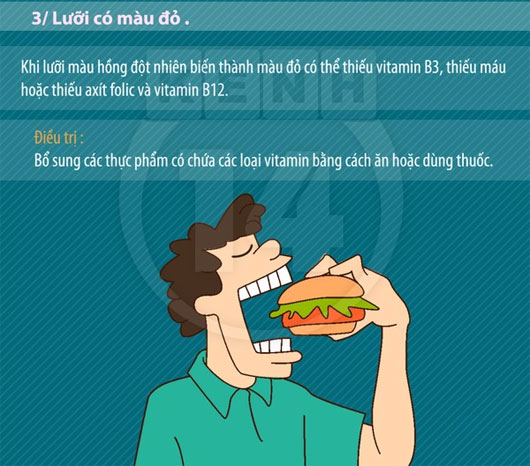 Ngó nghiêng chiếc lưỡi để đoán biết bệnh tật