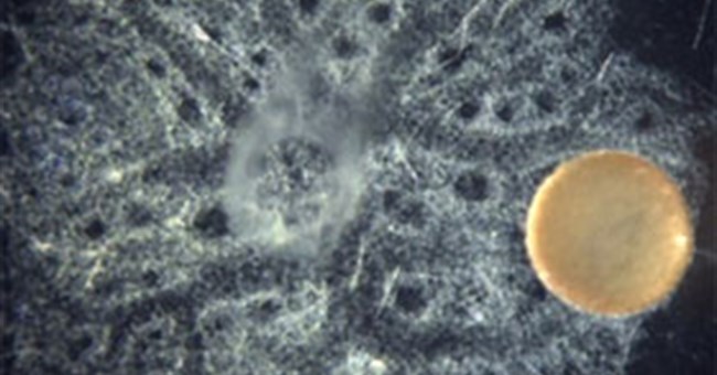 Tìm hiểu loài động vật không não biết "hắt hơi" như người