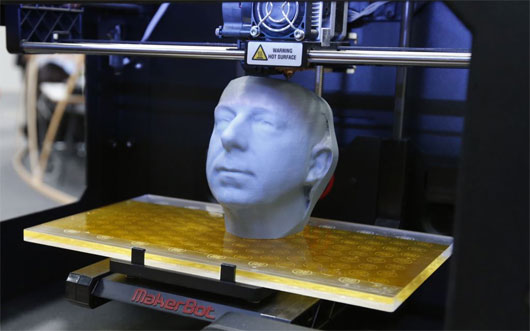 Tái tạo xương chậu bằng titan nhờ vào công nghệ in 3D