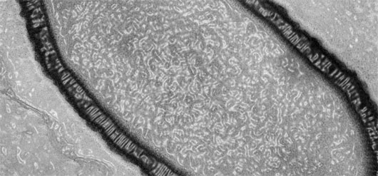 Đánh thức virus từng tồn tại từ 30.000 năm trước