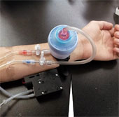 Màng lọc máu làm bằng sợi nano hứa hẹn thay thế máy chạy thận