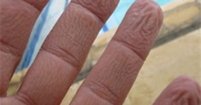 Vì sao tay người trẻ bị nhăn khi ngâm nước, tay người già thì không?