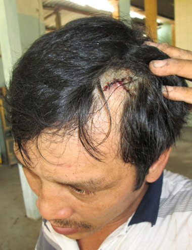 Lốc xoáy kèm mưa đá mạnh chưa từng có ở Quảng Ngãi