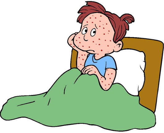 Người mắc bệnh thuỷ đậu tại Hà Nội đột ngột tăng cao