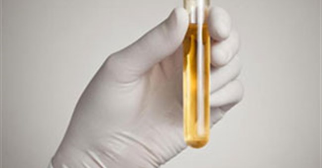 Xem nước tiểu để biết bạn khỏe hay yếu