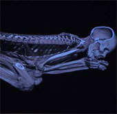 Giải mã xác ướp Ai Cập nhờ máy chụp cắt lớp CT mới