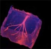 In mạch máu người bằng máy in 3D