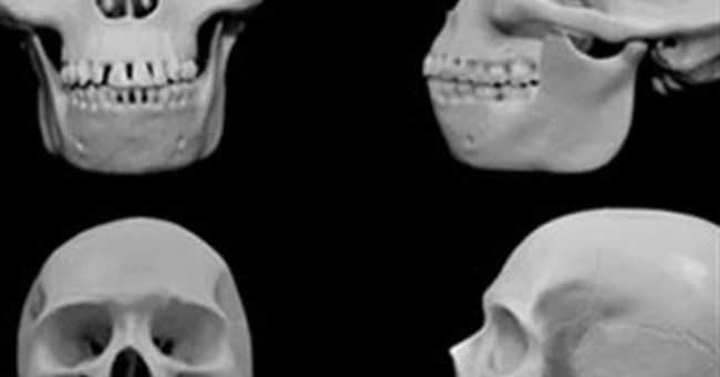 Khuôn mặt con người tiến hóa để tránh bị chấn thương
