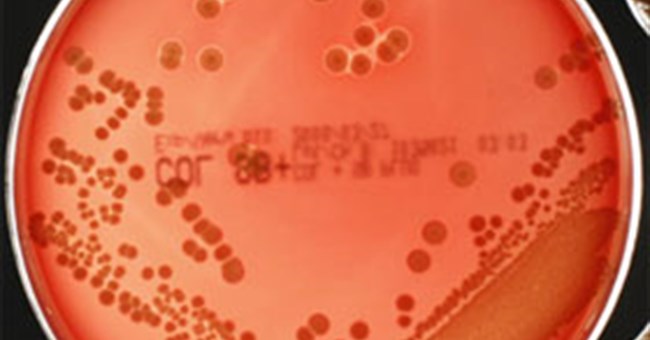 Phát hiện điểm yếu của “siêu vi khuẩn” kháng thuốc