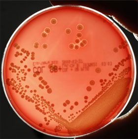 Phát hiện điểm yếu của “siêu vi khuẩn” kháng thuốc