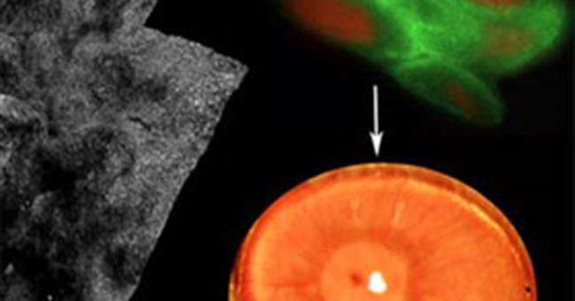 Đột phá mới giúp người mù sáng mắt