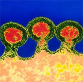 Đã tìm ra "khắc tinh" của virus HIV