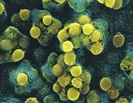 Virus nhiễm 