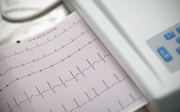 Chụp ảnh mặt chẩn đoán tình trạng tim