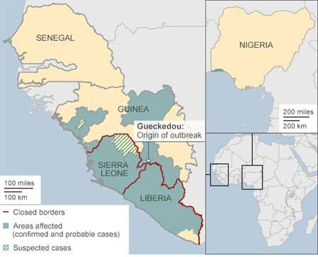 Nguyên nhân thế giới bó tay với dịch Ebola
