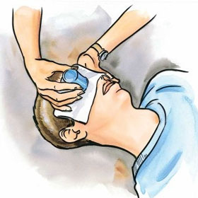 Cách xử trí và phòng ngừa chấn thương mắt ở trẻ