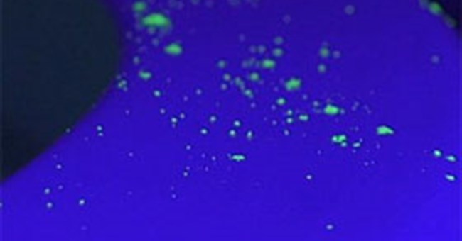 Xem cách vi khuẩn lan nhanh từ bồn cầu đến miệng người