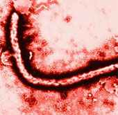 Phát hiện thời điểm xuất hiện của virus Ebola đầu tiên trên thế giới