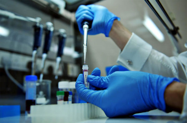 Tìm ra cách mới chữa HIV