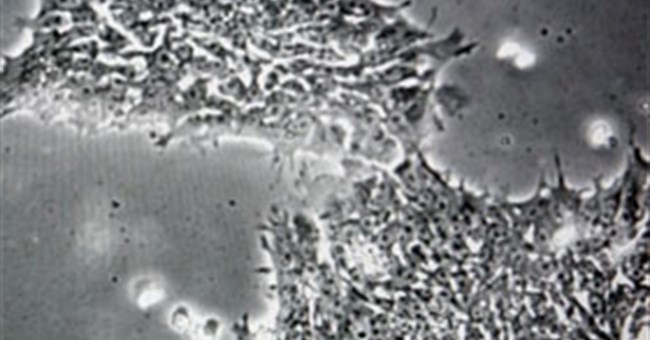 Phát hiện virus khiến con người bị ngớ ngẩn