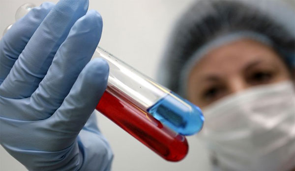 Các nhà khoa học phát triển phương pháp xét nghiệm nhanh virus cúm