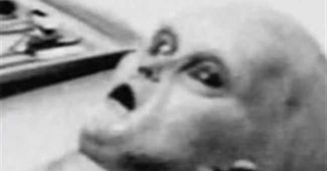 Công bố ảnh "mổ tử thi người ngoài hành tinh"