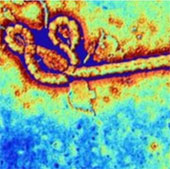 Ngừng thử nghiệm vắc xin Ebola do tác dụng phụ